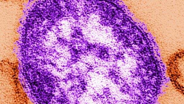 ダブリンからティペラリー行きバスの乗客が麻疹に感染 – ホームページ