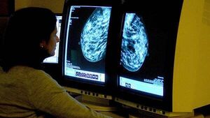 HSE says ‘problem’ with viewing BreastCheck register will be fixed next week
