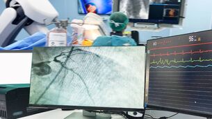 <p>It is highly anticipated that the Fianna Fáil gathering in the Granville Hotel on March 23 will coincide with an announcement of the start date for 24/7 cardiology at UHW. </p>