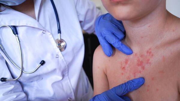 Scabies outbreak among students at Waterford’s SETU campus