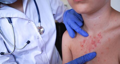 Scabies outbreak among students at Waterford’s SETU campus 