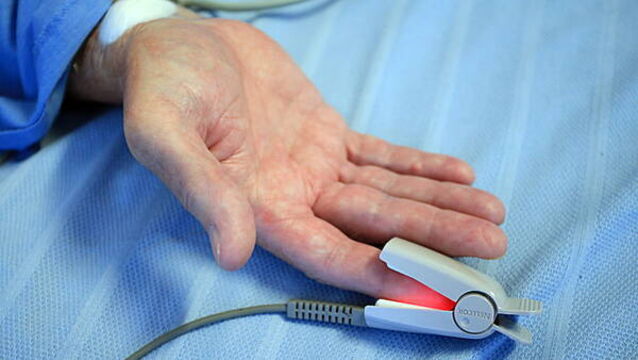 April 2026 the worst April on record for hospital overcrowding, INMO says